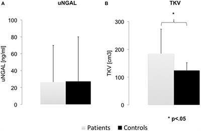 Early Urinary Biomarkers in Pediatric Autosomal Dominant Polycystic Kidney Disease (ADPKD): No Evidence in the Interest of Urinary Neutrophil Gelatinase-Associated Lipocalin (uNGAL)